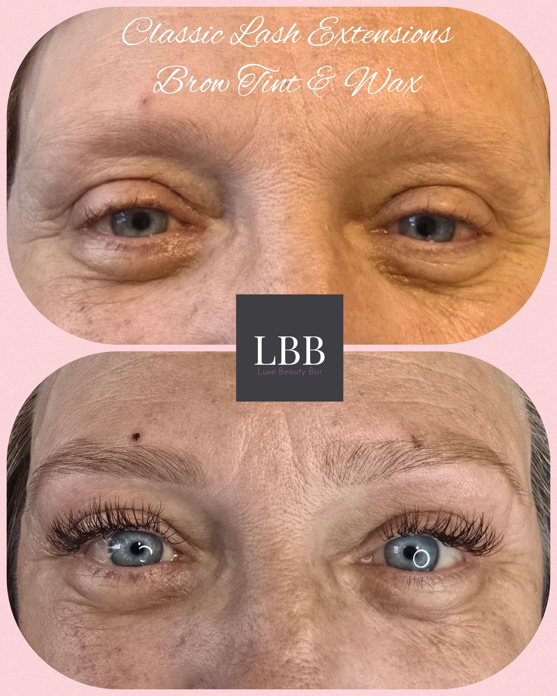 Beauty treatment results